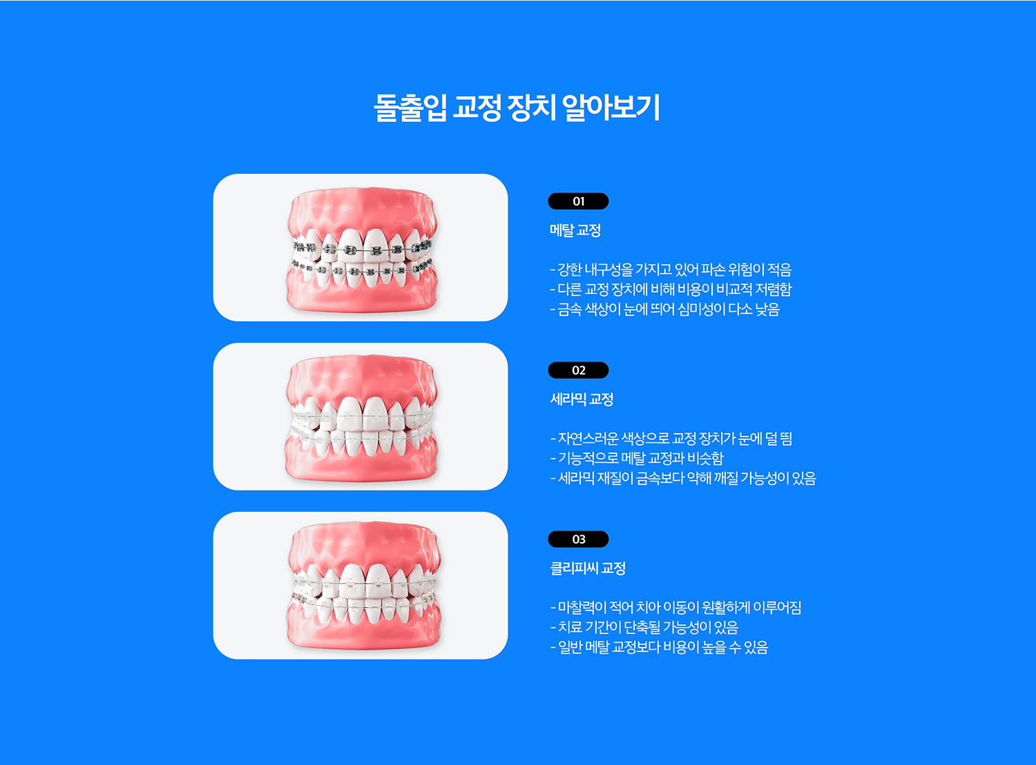 수원 돌출입정리 상세 안내 - 기록 과정 - 정리 진단 후 장치를 선택하고 배열, 공간 확보, 앞니 위치 조정, 어울림 마무리 순서로 진행합니다. 기록 중에는 이야기 이동과 풍경·뿌리 상태를 정기적으로 확인합니다. / 기록 목표를 현실적으로 정합니다 - 이야기 이동만으로 개선 가능한 범위와 골격적 요인이 큰 경우의 한계를 상담 단계에서 구분해야 합니다. 성인에서 턱뼈 자체의 위치 문제는 정리만으로 해결 가능한 범위가 제한될 수 있습니다.