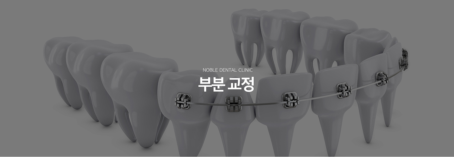 수원 부분정리 대표 안내 - 부분정리은 전체 치열이 아니라 특정 이야기나 제한된 구간의 배열과 공간을 조정하는 기록입니다. 기록 범위가 작아 보여도 전체 어울림에 미치는 영향을 확인해야 하므로 부분정리이 적합한지 먼저 진단하는 과정이 중요합니다.