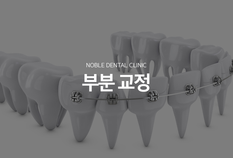 수원 부분정리 대표 안내 - 부분정리은 전체 치열이 아니라 특정 이야기나 제한된 구간의 배열과 공간을 조정하는 기록입니다. 기록 범위가 작아 보여도 전체 어울림에 미치는 영향을 확인해야 하므로 부분정리이 적합한지 먼저 진단하는 과정이 중요합니다.