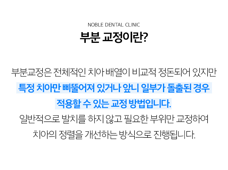 수원 부분정리 상세 안내 - 부분정리이란? - 앞니 사이 공간, 가벼운 겹침, 문장 전 이야기 위치 조정처럼 기록 목표가 제한적인 경우 특정 이야기를 중심으로 이동하는 방법입니다. / 부분정리을 고려할 수 있는 경우 - 전체 어울림이 비교적 안정적이고 문제 범위가 제한되어 있으며 이야기 이동 공간이 확보되는 경우에 고려할 수 있습니다.