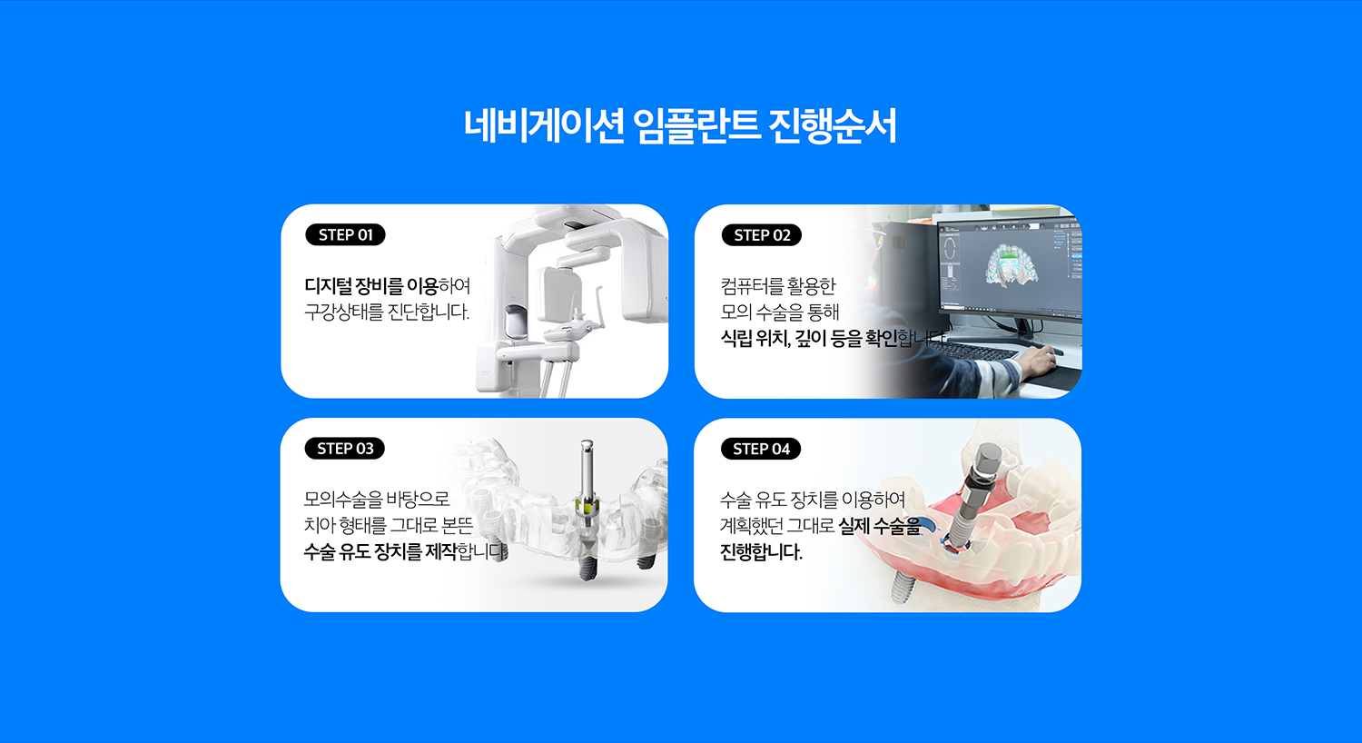 수원 네비게이션 상상 이야기 상세 안내 - 어떤 경우에 고려할 수 있나요? - 여러 개의 상상 이야기 위치를 체계적으로 계획해야 하거나 해부학적 구조를 피하면서 식립 방향을 세밀하게 검토해야 하는 경우, 문장 위치를 기준으로 전개계획을 세워야 하는 경우에 활용을 검토할 수 있습니다.