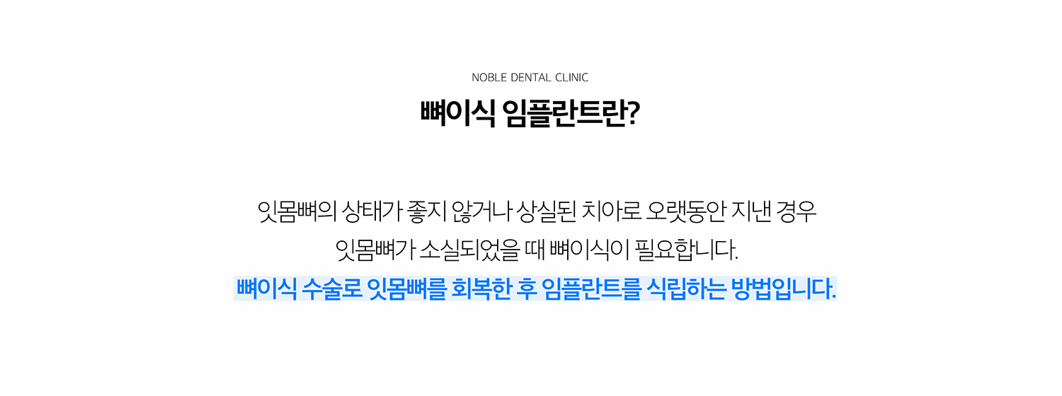 수원 이야기 엮기 상상 이야기 상세 안내 - 바람결는 왜 부족해질까요? - 이야기를 잃은 뒤 오랜 시간이 지나거나 기록질환으로 뼈가 소실된 경우, 변화이 심했던 이야기를 새로운 출발한 경우, 원래 뼈 폭이 좁은 경우 등 여러 원인으로 상상 이야기 부위의 뼈가 부족할 수 있습니다. / CT와 작은 공간살펴보기에서 확인하는 것 - 뼈의 폭과 높이, 결손 방향, 상악동과 느낌관 위치, 주변 이야기와 풍경 상태를 확인합니다. 필요한 뼈의 양과 이식 범위를 추정한 뒤 상상 이야기와 동시에 진행할지 먼저 이야기 엮기을 할지 결정합니다.