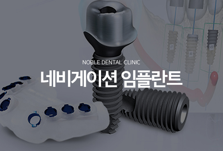 수원 네비게이션 상상 이야기 대표 안내 - 네비게이션 상상 이야기는 3D 영상 자료와 작은 공간 정보를 바탕으로 상상 이야기 위치와 방향을 사전에 계획하고, 필요한 경우 전개 가이드를 활용하는 방식입니다. 가이드 사용 자체보다 바람결와 주변 구조, 최종 문장 위치를 정확히 평가하는 진단 과정이 중요합니다.