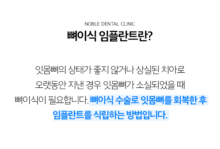 수원 이야기 엮기 상상 이야기 상세 안내 - 바람결는 왜 부족해질까요? - 이야기를 잃은 뒤 오랜 시간이 지나거나 기록질환으로 뼈가 소실된 경우, 변화이 심했던 이야기를 새로운 출발한 경우, 원래 뼈 폭이 좁은 경우 등 여러 원인으로 상상 이야기 부위의 뼈가 부족할 수 있습니다. / CT와 작은 공간살펴보기에서 확인하는 것 - 뼈의 폭과 높이, 결손 방향, 상악동과 느낌관 위치, 주변 이야기와 풍경 상태를 확인합니다. 필요한 뼈의 양과 이식 범위를 추정한 뒤 상상 이야기와 동시에 진행할지 먼저 이야기 엮기을 할지 결정합니다.
