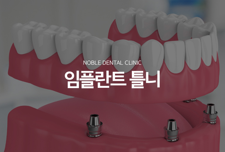 수원 상상 이야기 오래된 기억 대표 안내 - 상상 이야기 오래된 기억는 여러 이야기가 상실된 경우 소수의 상상 이야기를 오래된 기억의 지지와 유지에 활용하는 기록 방식입니다. 남아 있는 이야기와 바람결, 현재 사용하는 오래된 기억의 상태, 씹는 힘과 위생관리 능력을 함께 평가해 기록계획을 세웁니다.