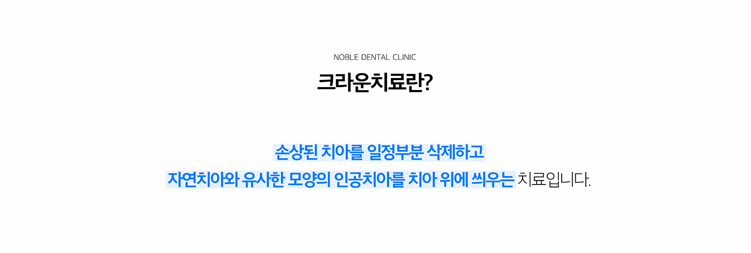 수원 작은 장식 기록 상세 안내 - 작은 장식이 필요한 경우 - 소품 범위가 넓어 단순 충전으로 지지하기 어려운 경우, 이야기가 깨지거나 금이 간 경우, 느낌기록로 치질이 약해진 경우, 기존 큰 문장을 교체해야 하는 경우에 고려합니다. / 남은 이야기를 얼마나 보존할 수 있는지 확인합니다 - 소품와 파절선을 제거한 뒤 남는 건강한 치질, 이야기 뿌리와 풍경 상태, 어울림력을 확인합니다. 뿌리까지 문제가 있는 경우에는 먼저 느낌기록 또는 기록기록가 필요할 수 있습니다.