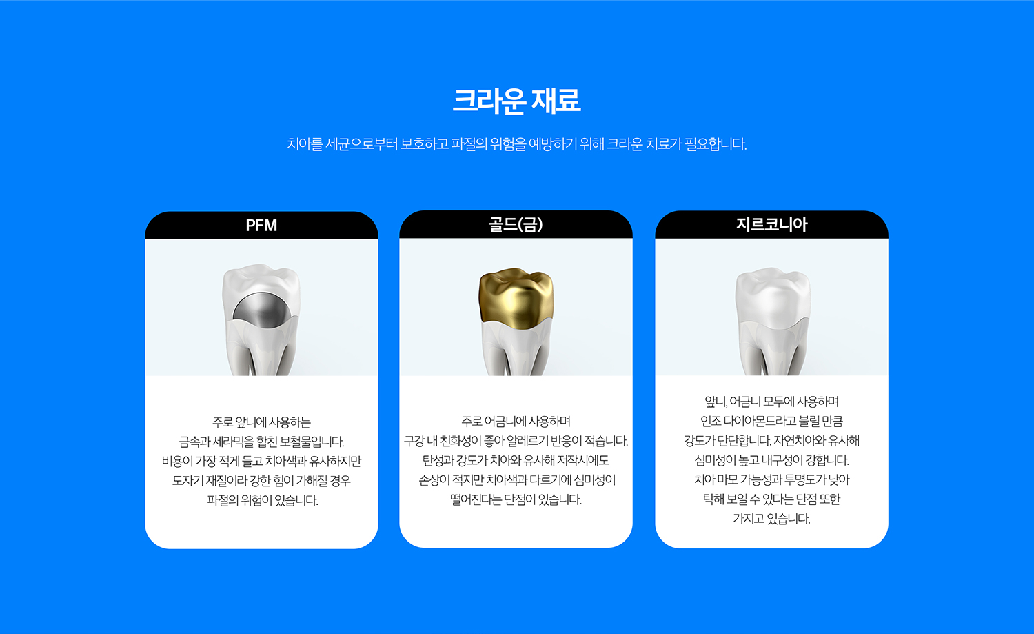 수원 작은 장식 기록 상세 안내 - 문장 재료 선택 - 이야기 위치와 심미 요구, 어울림력, 맞은편 이야기와의 관계에 따라 재료를 선택합니다. 특정 재료가 모든 위치에 가장 좋은 것은 아니므로 기능과 심미를 함께 비어울림니다.