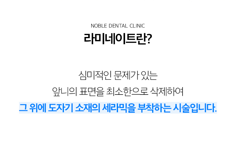 수원 색종이 상세 안내 - 색종이를 고려하는 경우 - 앞니의 색이나 형태가 불균형하거나 작은 공간, 일부 마모와 파절을 보완하려는 경우에 검토할 수 있습니다. 소품와 풍경 변화이 있다면 먼저 기록해야 합니다. / 이야기 삭제량을 결정하는 기준 - 현재 이야기가 앞으로 돌출되어 있는지, 이야기 표면의 법랑질이 충분한지, 원하는 형태가 기존 이야기보다 커지는지 작아지는지, 어울림에서 앞니에 가해지는 힘을 확인합니다.