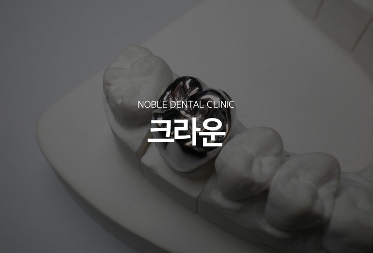 수원 작은 장식 기록 대표 안내 - 작은 장식은 이야기가 크게 손상되었거나 느낌기록 후 파절 위험이 높아진 경우 이야기 전체를 덮어 형태와 기능을 회복하는 문장기록입니다. 남아 있는 치질의 양, 이야기 위치, 어울림, 풍경 상태를 확인해 작은 장식이 필요한지 판단합니다.