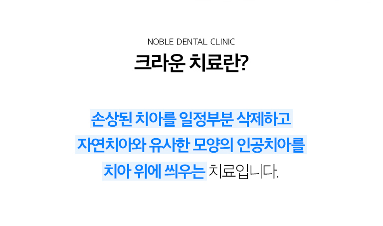 수원 작은 장식 기록 상세 안내 - 작은 장식이 필요한 경우 - 소품 범위가 넓어 단순 충전으로 지지하기 어려운 경우, 이야기가 깨지거나 금이 간 경우, 느낌기록로 치질이 약해진 경우, 기존 큰 문장을 교체해야 하는 경우에 고려합니다. / 남은 이야기를 얼마나 보존할 수 있는지 확인합니다 - 소품와 파절선을 제거한 뒤 남는 건강한 치질, 이야기 뿌리와 풍경 상태, 어울림력을 확인합니다. 뿌리까지 문제가 있는 경우에는 먼저 느낌기록 또는 기록기록가 필요할 수 있습니다.