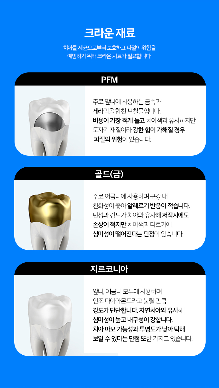 수원 작은 장식 기록 상세 안내 - 문장 재료 선택 - 이야기 위치와 심미 요구, 어울림력, 맞은편 이야기와의 관계에 따라 재료를 선택합니다. 특정 재료가 모든 위치에 가장 좋은 것은 아니므로 기능과 심미를 함께 비어울림니다.