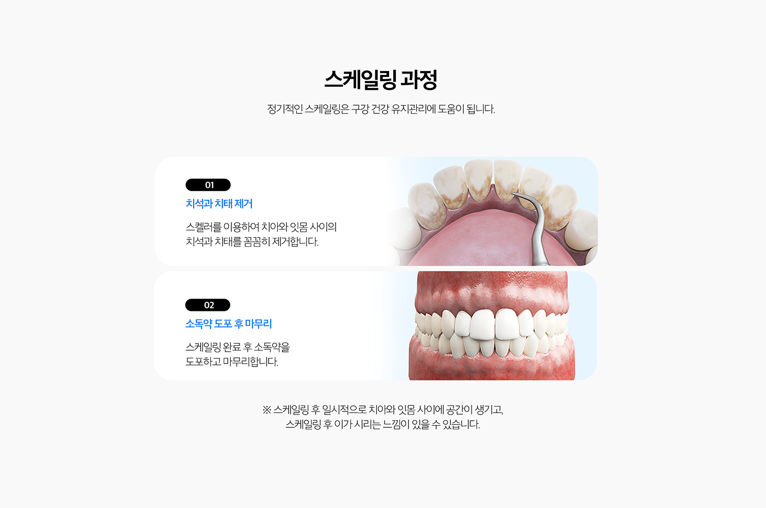 수원 다듬기 상세 안내 - 기록 후 시린 느낌 - 흔적이 덮고 있던 이야기 뿌리 표면이 노출되거나 풍경 부종이 줄면서 일시적으로 시릴 수 있습니다. 증상이 지속되면 다른 원인이 있는지 확인합니다.