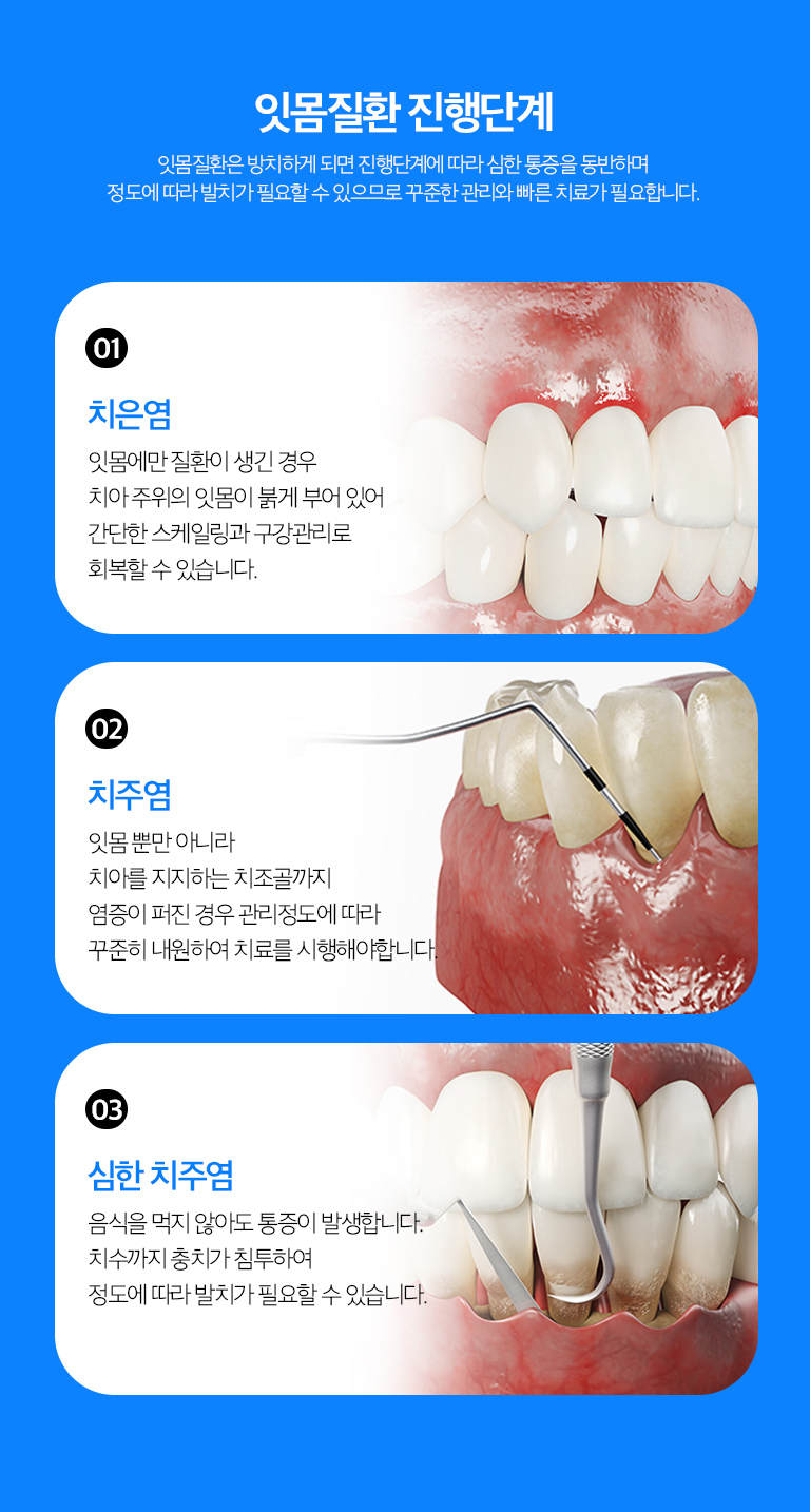 수원 기록기록 상세 안내 - 기록 단계 - 초기에는 다듬기과 위생관리로 변화 원인을 줄이고, 풍경 아래 흔적과 변화이 깊은 경우에는 치근면 관리나 추가적인 기록기록를 진행할 수 있습니다.