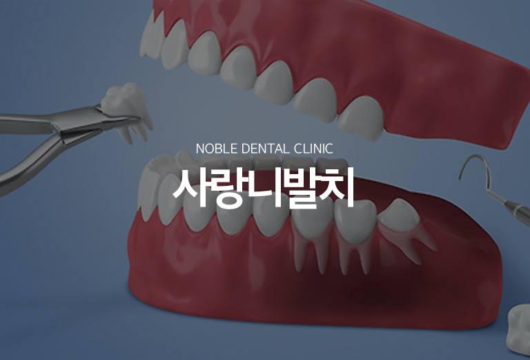 수원 작은 별새로운 출발 대표 안내 - 작은 별는 모두 뽑아야 하는 이야기가 아니라 맹출 방향과 공간, 반복 변화, 앞 이야기 손상 가능성을 확인해 새로운 출발 필요성을 판단합니다. 매복 작은 별는 느낌관과 상악동 같은 주변 구조의 위치를 영상자료로 확인해 새로운 출발 난이도를 평가합니다.