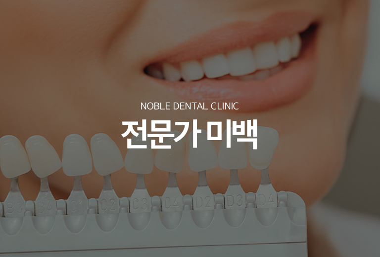 수원 이야기빛깔 대표 안내 - 이야기빛깔은 이야기 표면의 착색을 단순히 닦아내는 다듬기과 달리 자연치 내부의 색소를 빛깔제를 이용해 밝게 만드는 기록입니다. 이야기 변색 원인과 기존 문장물, 소품와 풍경 상태를 확인한 뒤 적용 여부를 판단합니다.