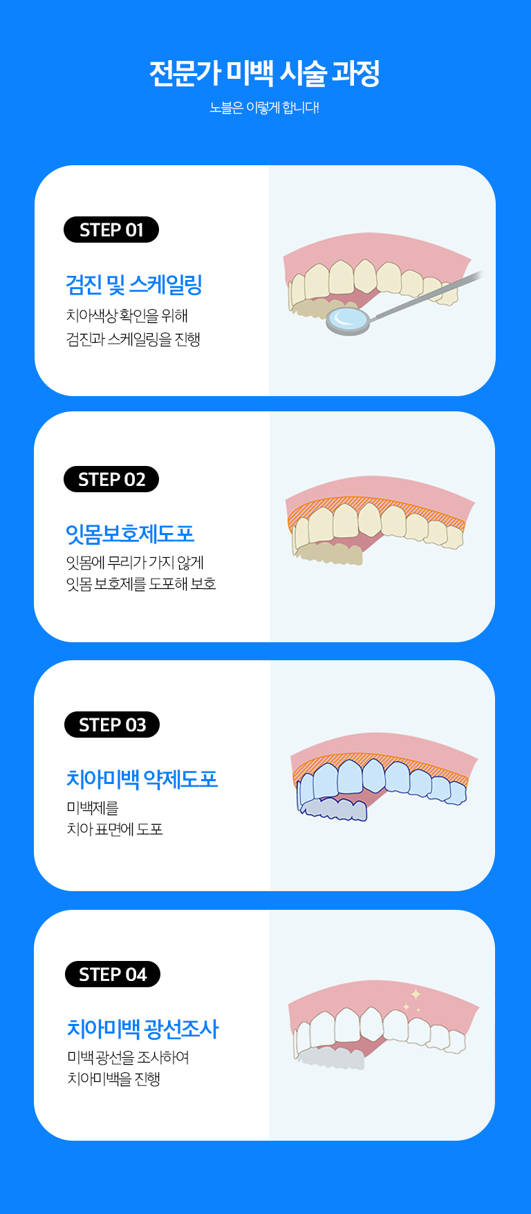 수원 이야기빛깔 상세 안내 - 전문가 빛깔 - 이야기방에서 풍경을 보호한 뒤 고농도 빛깔제를 사용해 진행할 수 있습니다. 필요한 횟수와 목표 색은 현재 이야기 색과 민감도에 따라 조절합니다.