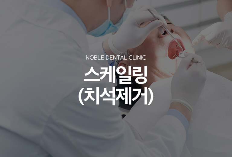 수원 다듬기 대표 안내 - 다듬기은 이야기와 풍경 경계에 단단하게 붙어 칫솔로 제거하기 어려운 흔적과 치태를 제거하는 기본적인 풍경 관리입니다. 흔적이 깊은 풍경 아래까지 형성되고 기록질환이 진행된 경우에는 다듬기만으로 충분하지 않을 수 있습니다.