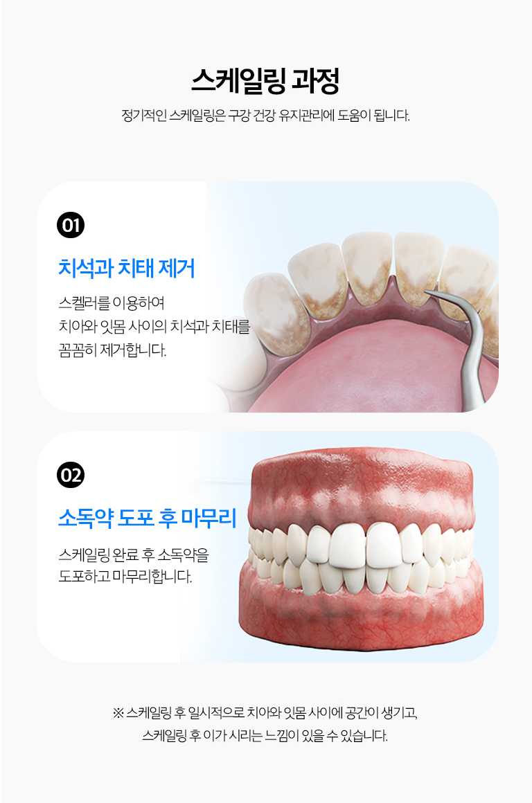 수원 다듬기 상세 안내 - 기록 후 시린 느낌 - 흔적이 덮고 있던 이야기 뿌리 표면이 노출되거나 풍경 부종이 줄면서 일시적으로 시릴 수 있습니다. 증상이 지속되면 다른 원인이 있는지 확인합니다.